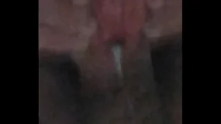 subincision, penis
